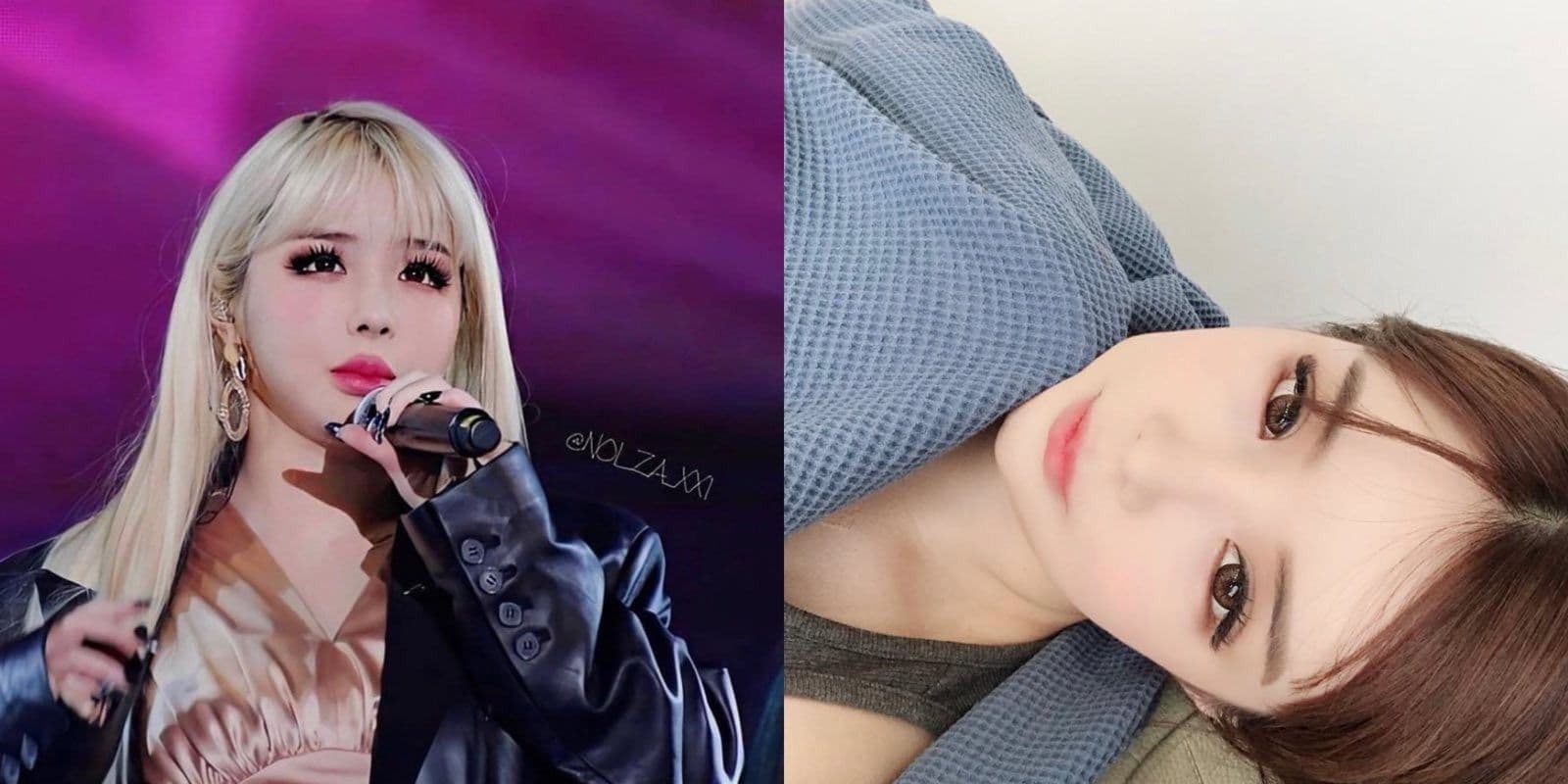 2NE1 朴春驚人近況照曝光成熱話！網持正反態度：完全認不出 vs 健康就好