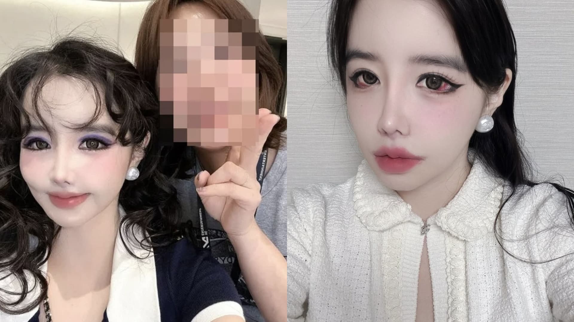 整張臉越變越扭曲?朴春疑似「整形上癮」粉絲崩潰苦求:不要再整了!
