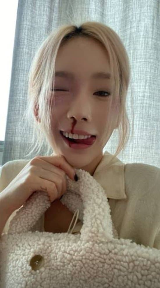 Image Source_Instagram | taeyeon_ss