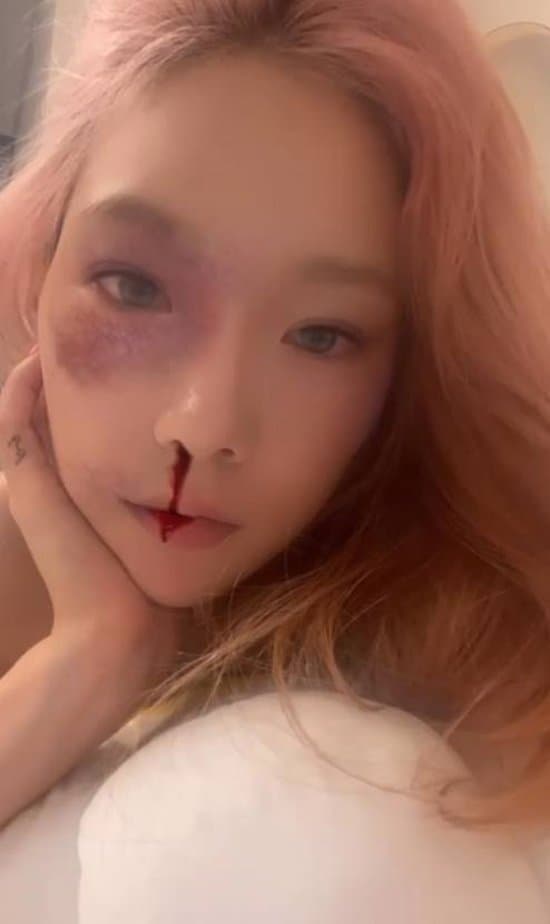 Image Source_Instagram | taeyeon_ss