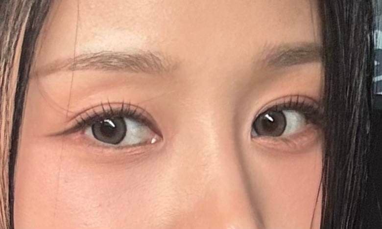 [데이터 리포트] K-뷰티 시술 후기 분석: 만족도 핵심 요인은?