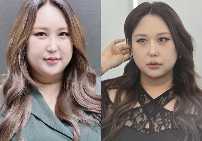 37kg 감량, 몰라보게 달라진 근황