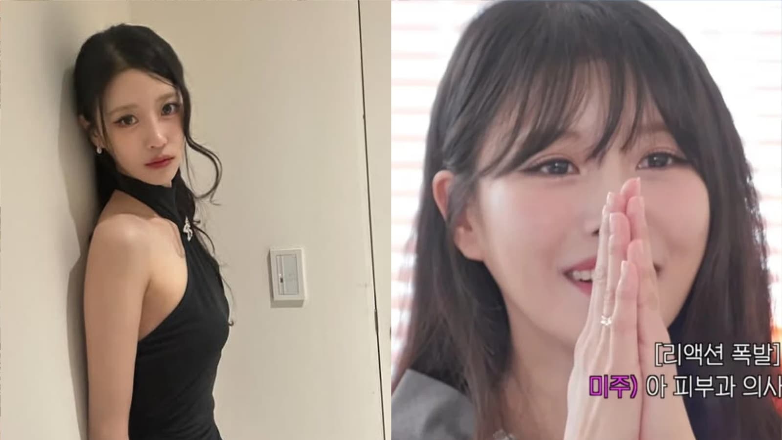 被分手1年半後首相親!Lovelyz李美珠狂撩皮膚科醫師 直球示愛還交換電話